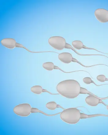 Abnormal Sperm Morphology (Teratospermia)